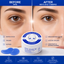 Fruit Of The Wokali | Hyaluronic Acid | Hydrogel Eye Patches 60τμχ | Βαθιά Ενυδάτωση & Λείανση | FOTWHAEP
