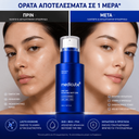 Medicube | One Day Exosome Shot 2000 | Pore Refining Ampoule 30ml | Brightening & Skin Smoothing | MODES2000