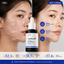 Medicube | Zero Pore One Day Serum 30ml | AHA + BHA + PHA Exfoliating Pore Serum | Smoother Skin & Refined Pores | MZPODS
