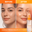 Sunkissed Skin | Vitamin C Energising Face Mist | Brightening, Hydrating & Protecting Spray 100ml | SU31848