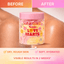 Sunkissed x Love Hearts | Pineapple Smoothie Body Butter 250g | Whipped Moisturising Body Butter | SU32482